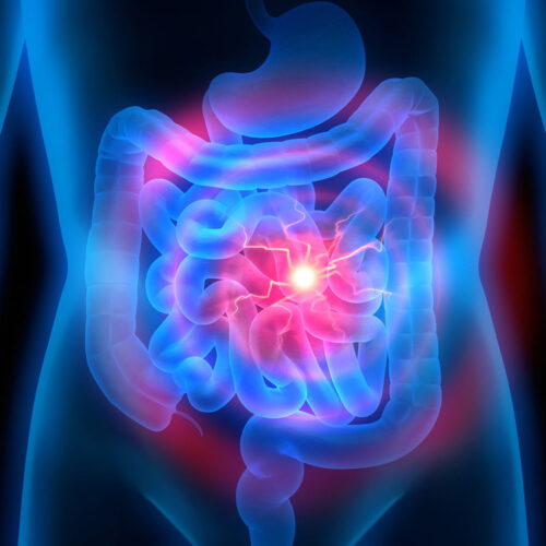 Endoscopia digestiva Gastroenterologia